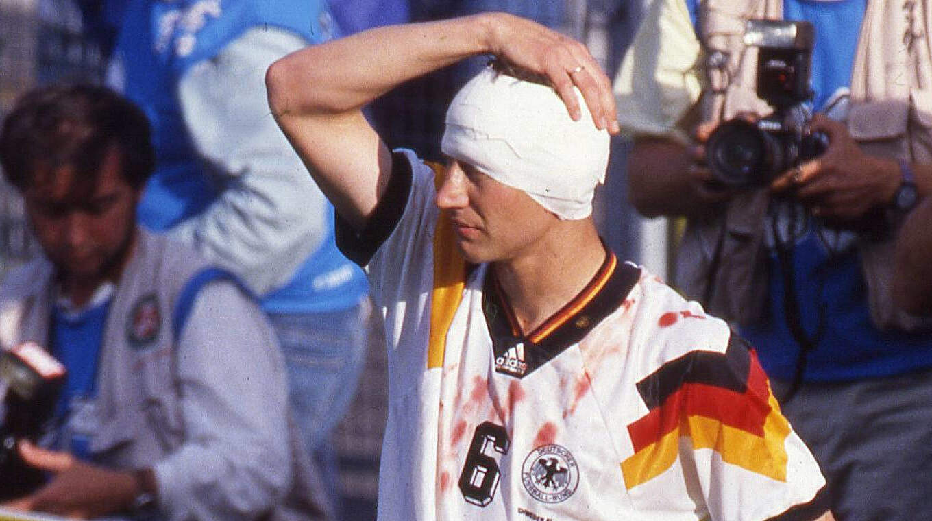 Guido im Turban: Das EM-Spiel gegen Schottland bereitete ihm Kopfschmerzen © Imago Images